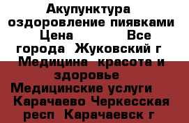 Акупунктура, оздоровление пиявками › Цена ­ 3 000 - Все города, Жуковский г. Медицина, красота и здоровье » Медицинские услуги   . Карачаево-Черкесская респ.,Карачаевск г.